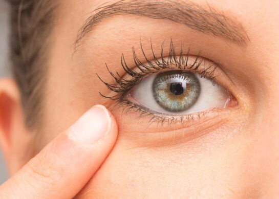 10 cosas que dicen los ojos sobre tu salud